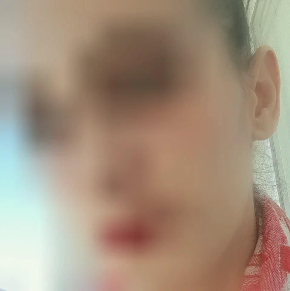 Alice, 37 anni